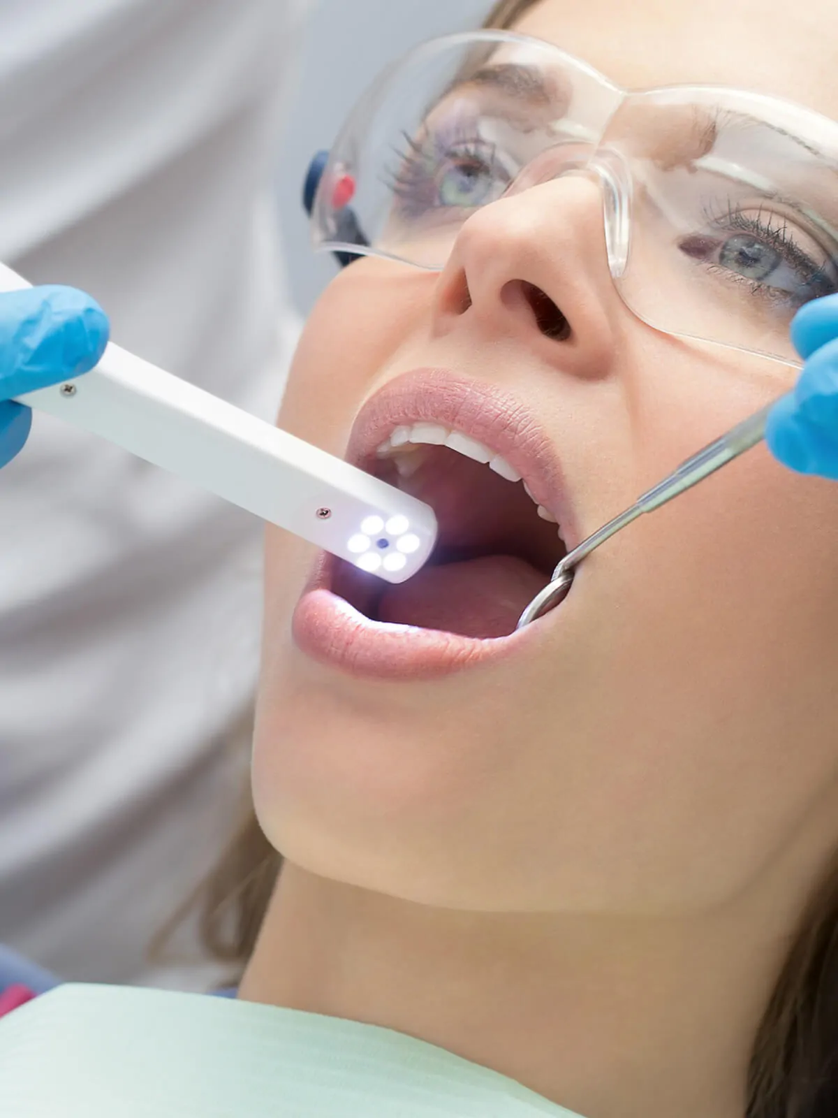 pd-gallery-intraoral-photos